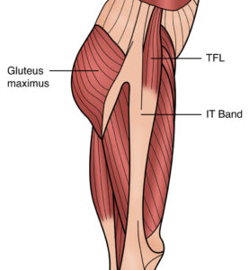 TFL continuous with IT band