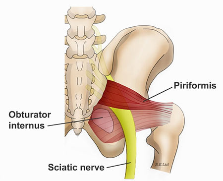 Piriformis muscle visual aid