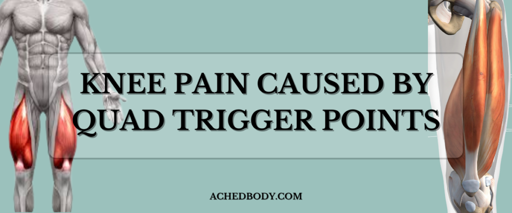 can trigger points in quads cause knee pain?