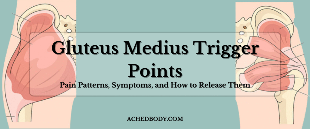 Gluteus Medius Trigger Points: Pain Patterns, Symptoms, and How to Release Them