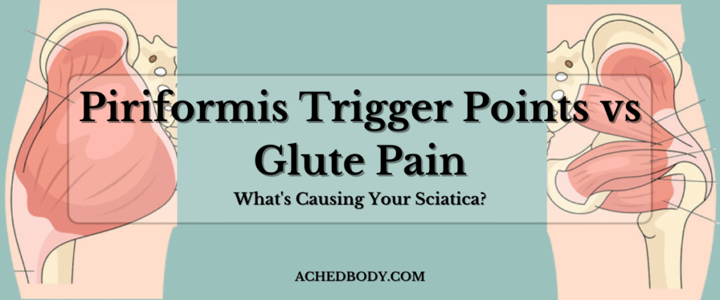 Piriformis Trigger Points vs Glute Pain: What's Causing Your Sciatica?