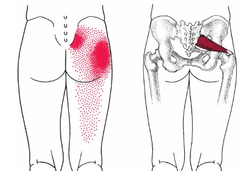 Piriformis Trigger Points