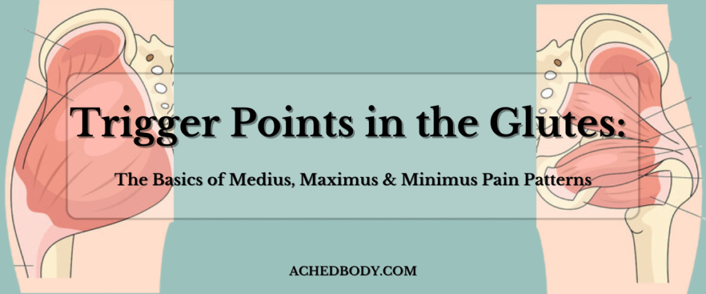 Trigger Points in the Glutes: The Basics of Medius, Maximus & Minimus Pain Patterns