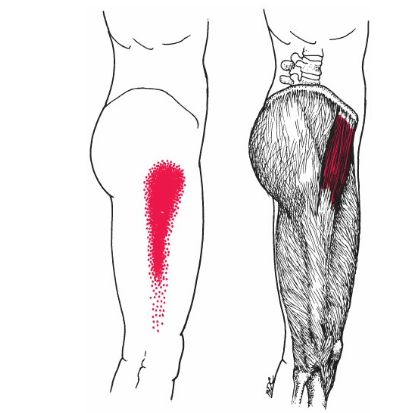 TFL muscle pain pattern