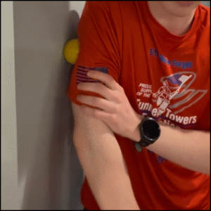 upper tricep trigger point image